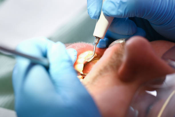 Best Holiday Emergency Dentist in Byron, GA