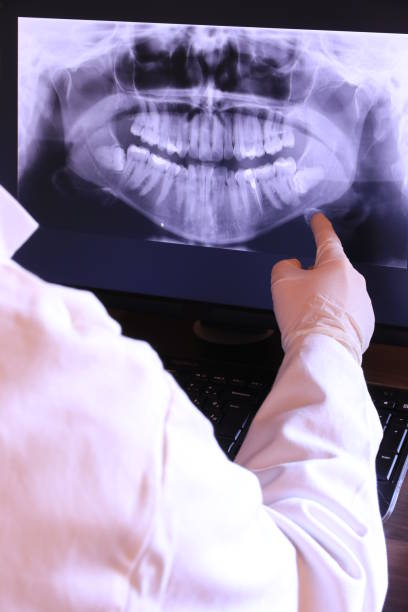 Best Emergency Root Canal Treatment in Byron, GA