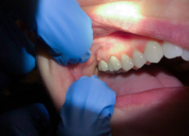 Best Mobile Emergency Dentist in Byron, GA